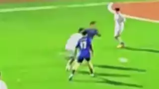player 87